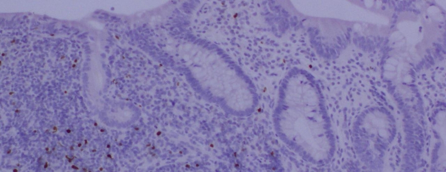 La Sra. Anna Carrasco presenta su tesis doctoral sobre la inmunología de la mucosa intestinal en condiciones de salud y en diferentes enfermedades inflamatorias intestinales.