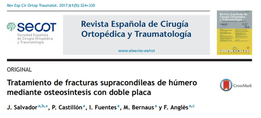 La Revista Española de Cirugía Ortopédica y Traumatología publica un artículo sobre el tratamiento de fracturas supracondíleas de húmero