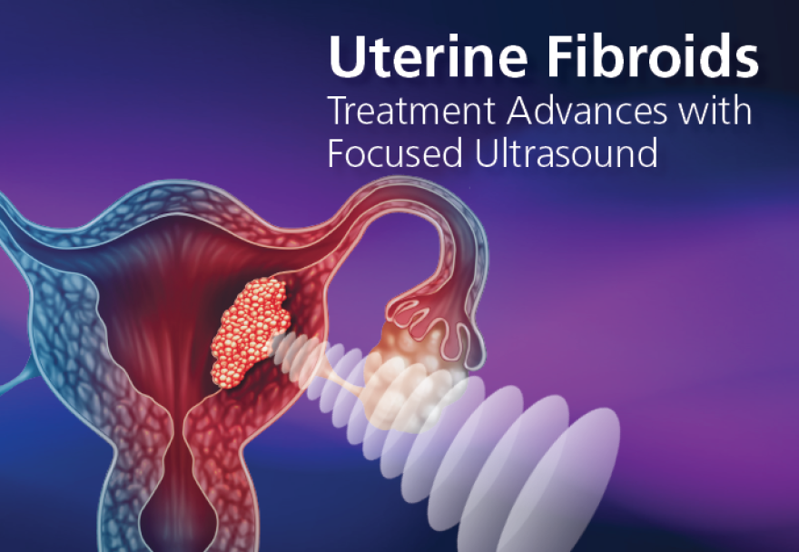 El Dr. Jordi Rodríguez intervé com a expert en el workshop Advances in the Focused Ultrasound Treatment of Uterine Fibroids